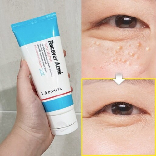 라보니따 리커버 아크네 폼 클렌저