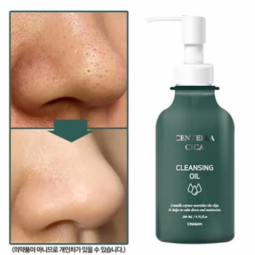 센텔라시카 기미비립종 클렌징 오일