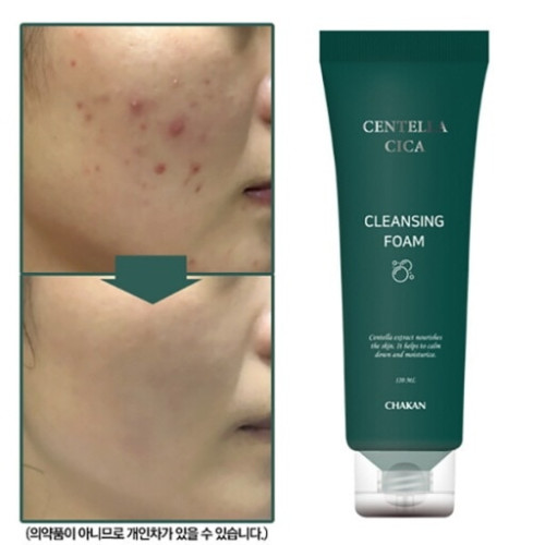 센텔라시카 기미비립종 클렌징폼
