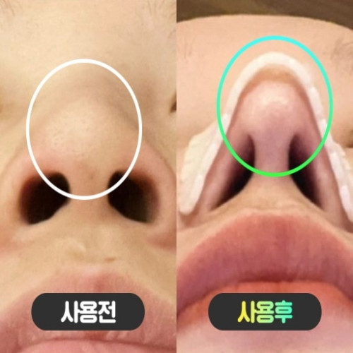 10분 노즈 라이너