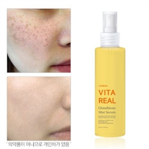 글루타치온 기미 미스트 세럼